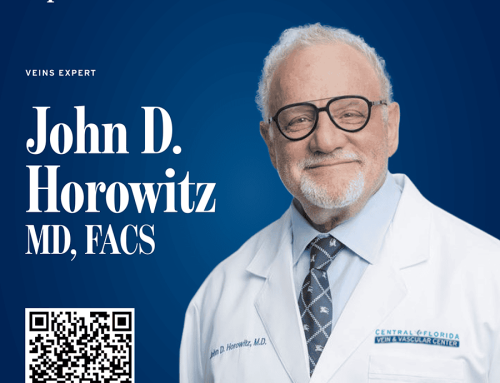 Leg Pain, Swelling and Heaviness May be Signs of an Underlying Vein Condition